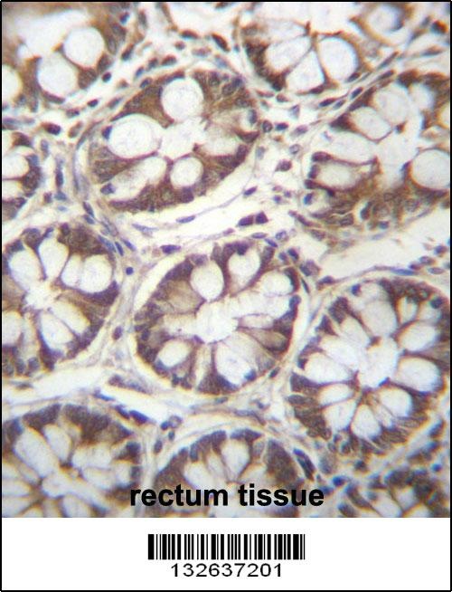 LAD1 Antibody