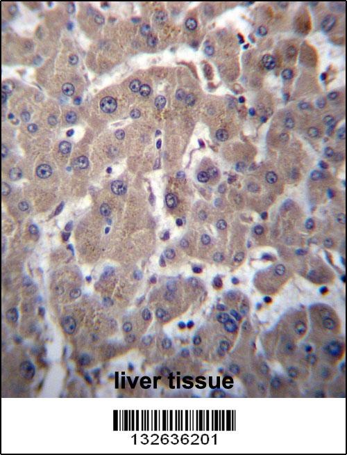 YIPF1 Antibody