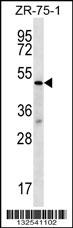 TBL2 Antibody