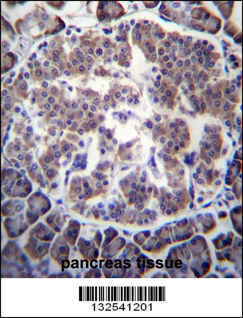 TBL2 Antibody