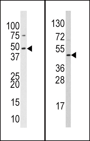 SUV39H2 Antibody