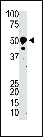 SUV39H2 Antibody