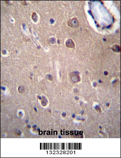 SLC8A3 Antibody