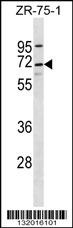 PEO1 Antibody