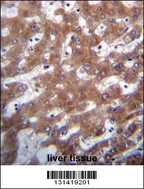 TRUB1 Antibody