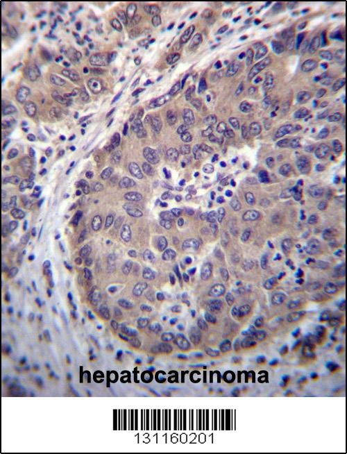 PNLIPRP3 Antibody