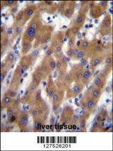 UBAP2 Antibody