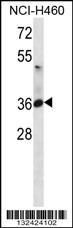 ATP1B3 Antibody