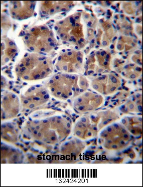 ATP1B3 Antibody