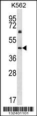 KRT12 Antibody