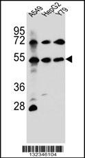 FGFRL1 Antibody