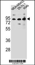 CTTNBP2NL Antibody
