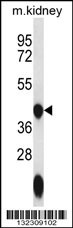 GTPBP10 Antibody