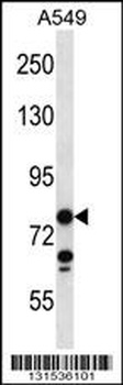 CCDC13 Antibody