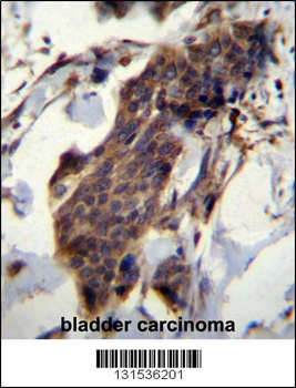 CCDC13 Antibody
