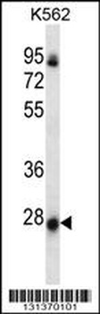 NRSN2 Antibody