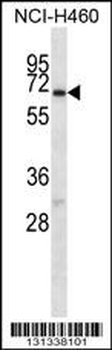 GABRA4 Antibody