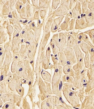 PLOD1 Antibody