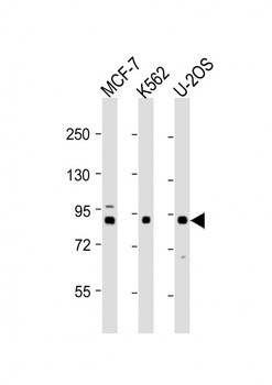 PLOD1 Antibody