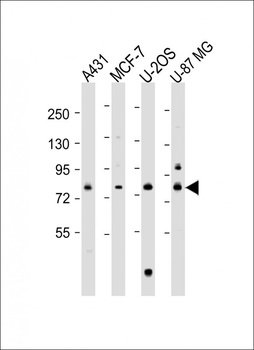 PLOD1 Antibody