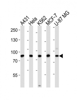 PLOD1 Antibody