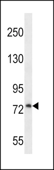 PLOD1 Antibody