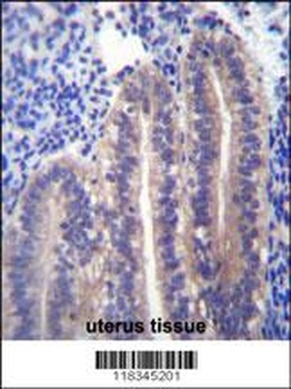 ANGPTL7 Antibody