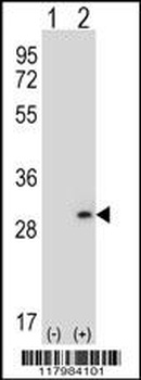 DPT Antibody