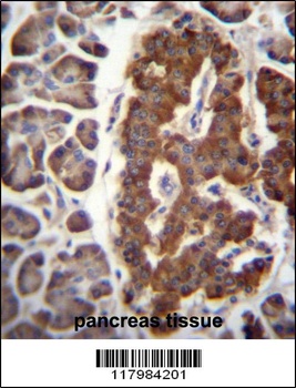 DPT Antibody
