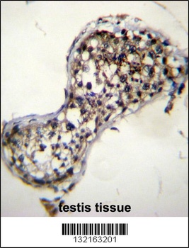 SQLE Antibody