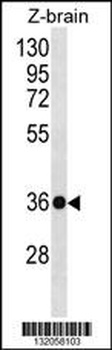 HOXD10 Antibody