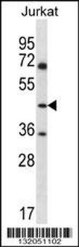 ASS1 Antibody