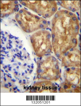 ASS1 Antibody