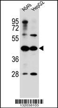 ACSM6 Antibody