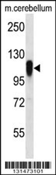 FBX41 Antibody