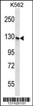 SH3TC1 Antibody