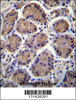 SH3TC1 Antibody