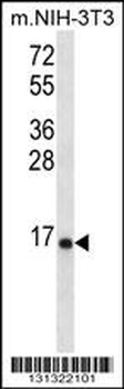RPL23 Antibody
