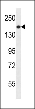 PREX1 Antibody