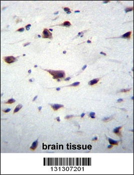 PREX1 Antibody