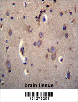 DTNA Antibody