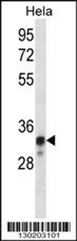 NDUFS8 Antibody