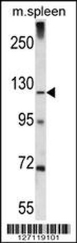 KIAA1324 Antibody