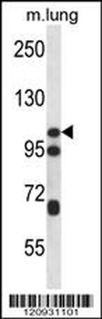 CTNND2 Antibody