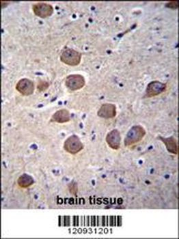 CTNND2 Antibody