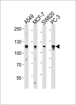 GAA Antibody