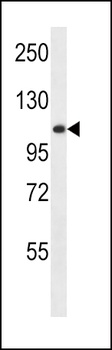 GAA Antibody