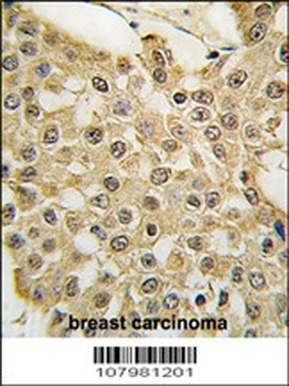 MDM2 Antibody