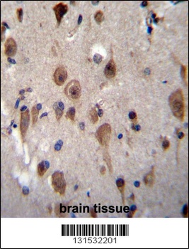 LRRC28 Antibody