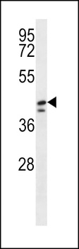 DUS1L Antibody